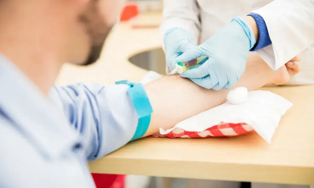 Zdjęcie Niskie PDW w morfologii: Kiedy powinieneś się naprawdę niepokoić?